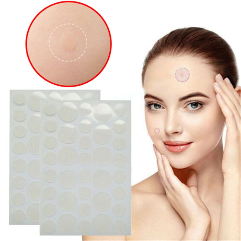 Acne Patches