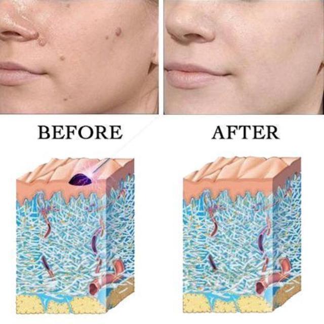 Magic Skin Spots Remover